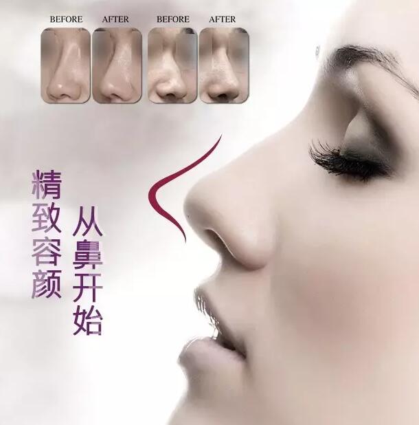 精致容顏，從鼻開(kāi)始