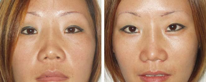 NAB 提升駐顏——李女士